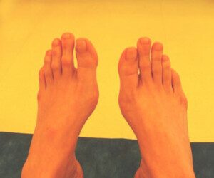 Operacja stopy - skracanie palców